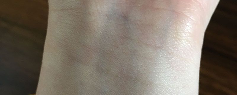 紫色血管是冷皮还是暖皮