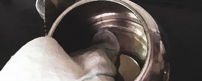 不锈钢刮花了能恢复吗