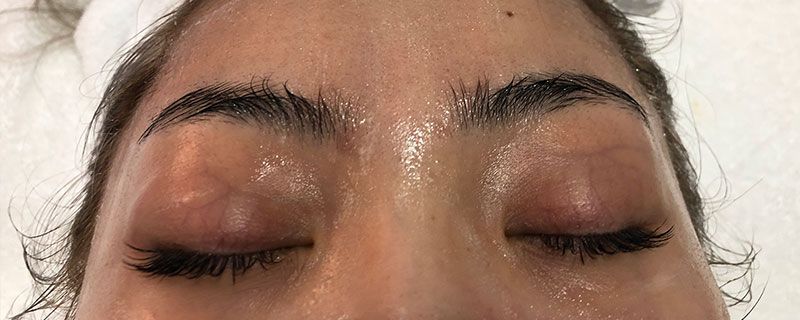 眉间纹去除的小窍门