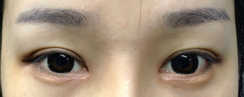 厌世眼和死鱼眼的区别