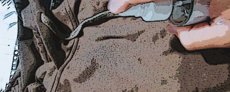 75%酒精怎么给衣服消毒